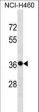 GSX2 Antibody western blot of NCI-H460 cell line lysates (35 ug/lane). The GSX2 antibody detected the GSX2 protein (arrow).