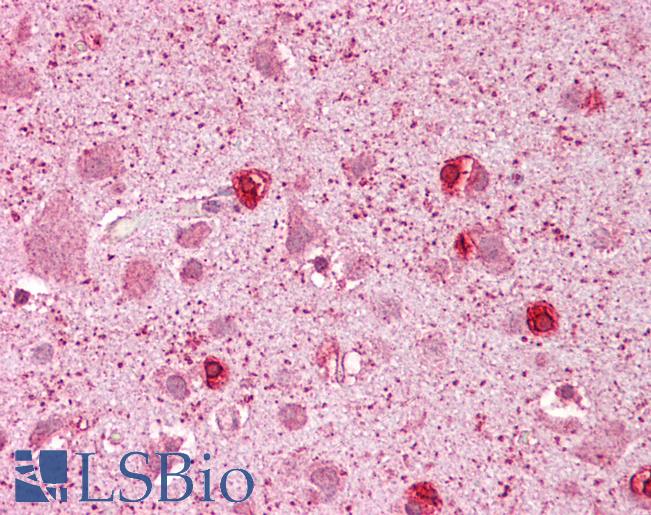 Anti-GSX2 / GSH2 antibody IHC of human brain, cortex. Immunohistochemistry of formalin-fixed, paraffin-embedded tissue after heat-induced antigen retrieval. Antibody LS-B6736 concentration 5 ug/ml.