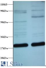 Western blot of ES1 protein homolog, mitochondrial antibody at 2 ug/ml. Lane 1: EC109 whole cell lysate. Lane 2: 293T whole cell lysate. . . Secondary: Goat polyclonal to Rabbit IgG at 1:15000 dilution. . . Predicted band size:29 kDa. . Observed band size:29 kDa.