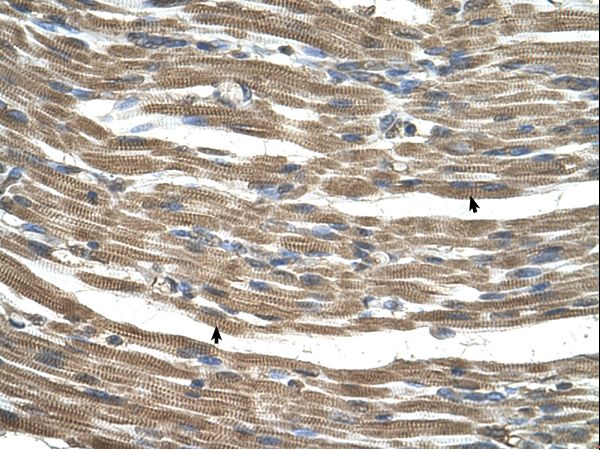 C21orf33 antibody LS-C80776 was used in IHC to stain formalin-fixed, paraffin-embedded human muscle.