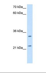 HepG2 cell lysate. Antibody concentration: 2.5 ug/ml. Gel concentration: 12%.