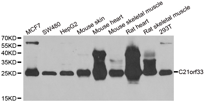 Western blot analysis of extracts of various cell lines, using C21orf33 antibody.