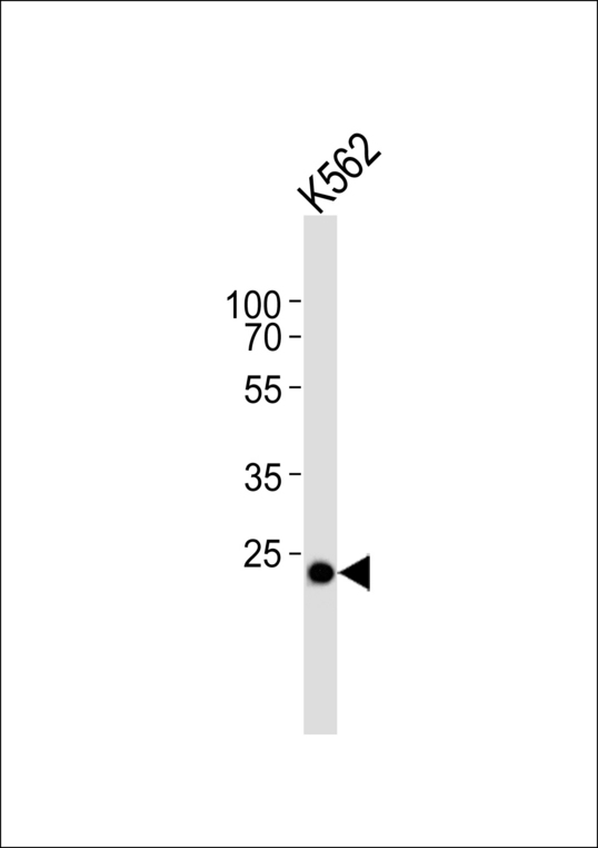 Western blot of lysate from K562 cell line with C21orf33 Antibody. Antibody was diluted at 1:1000. A goat anti-rabbit IgG H&L (HRP) at 1:5000 dilution was used as the secondary antibody. Lysate at 35 ug.