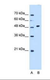 Lane A: Marker. Lane B: Jurkat cell lysate. Antibody concentration: 0.25 ug/ml. Gel concentration: 12%.