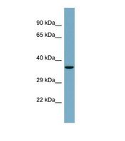 Western blot of Human PANC1. GTDC1 antibody dilution 1.0 ug/ml.