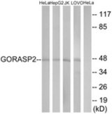 Western blot of extracts from HeLa/HepG2/Jurkat/LOVO cells, using GORASP2 Antibody. The lane on the right is treated with the synthesized peptide.