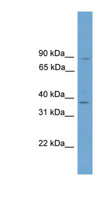 GTF2A1 antibody LS-C116777 Western blot of HepG2 cell lysate.