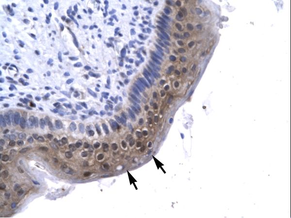 GTF2A1 antibody LS-C29726 was used in IHC to stain formalin-fixed, paraffin-embedded human spermatophore.