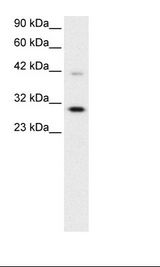 Jurkat Cell Lysate