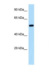 GORASP2 antibody LS-C146001 Western blot of MCF7 Cell lysate. Antibody concentration 1 ug/ml.