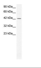 Jurkat Cell Lysate