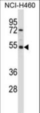 GTF2A1L Antibody western blot of NCI-H460 cell line lysates (35 ug/lane). The GTF2A1L antibody detected the GTF2A1L protein (arrow).