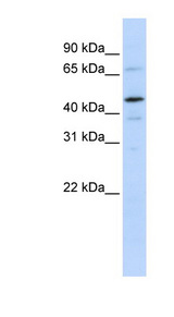 GTF2E1 antibody LS-C102857 Western blot of 721_B cell lysate.