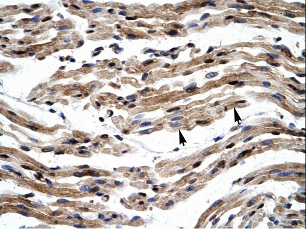 GTF2E1 antibody LS-C30076 was used in IHC to stain formalin-fixed, paraffin-embedded human muscle.