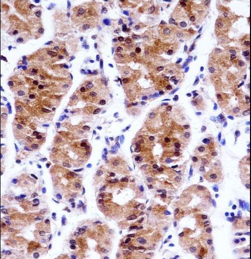 GTF2E1 Antibody immunohistochemistry of formalin-fixed and paraffin-embedded human stomach tissue followed by peroxidase-conjugated secondary antibody and DAB staining.