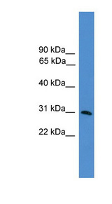 GTF2E2 antibody LS-C135052 Western blot of HepG2 cell lysate.