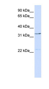GTF2E2 antibody LS-C101677 Western blot of 293T cell lysate.
