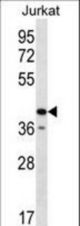 GORASP2 Antibody western blot of Jurkat cell line lysates (35 ug/lane). The GORASP2 antibody detected the GORASP2 protein (arrow).