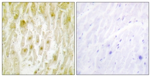 IHC of paraffin-embedded human heart tissue, using TF2E2 Antibody. The picture on the right is treated with the synthesized peptide.