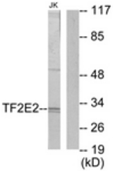 Western blot of extracts from Jurkat cells, using TF2E2 Antibody. The lane on the right is treated with the synthesized peptide.