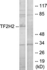 Western blot of extracts from COLO205 cells, using TF2H2 Antibody. The lane on the right is treated with the synthesized peptide.