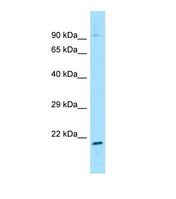 Western blot of Mouse Muscle. Gtf2h2 antibody dilution 1.0 ug/ml.
