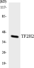 Western blot of the lysates from COLO205 cells using TF2H2 antibody.