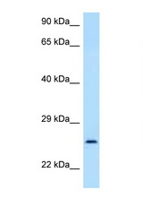 GOSR2 antibody LS-C146117 Western blot of 435S Cell lysate. Antibody concentration 1 ug/ml.