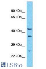 GTF2H2C antibody Western Blot of 293T. Antibody dilution: 1 ug/ml.