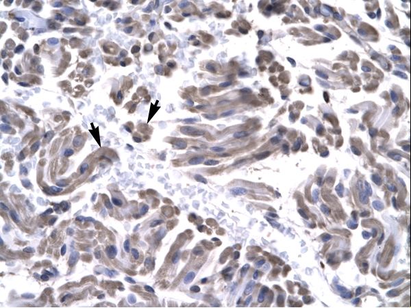 GTF2H3 antibody LS-C29668 was used in IHC to stain formalin-fixed, paraffin-embedded human muscle.