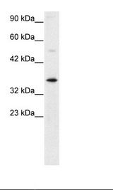 Jurkat Cell Lysate