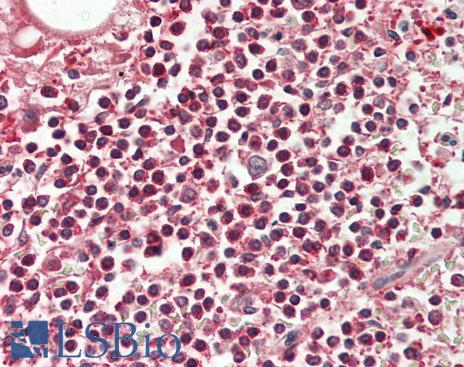 Human Spleen: Formalin-Fixed, Paraffin-Embedded (FFPE)