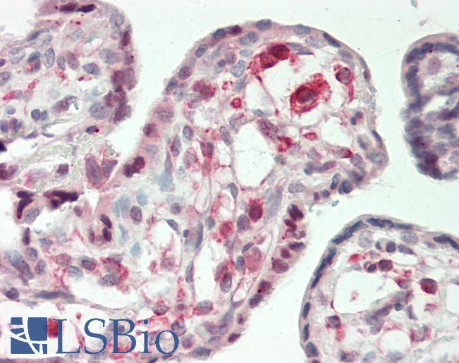 Human Placenta: Formalin-Fixed, Paraffin-Embedded (FFPE)