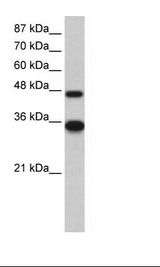 Transfected 293T Cell Lysate