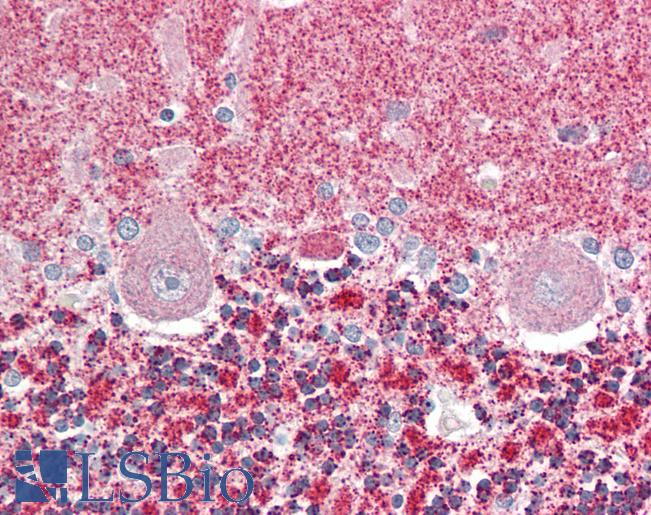Anti-GTF2H5 antibody IHC staining of human brain, cerebellum. Immunohistochemistry of formalin-fixed, paraffin-embedded tissue after heat-induced antigen retrieval.