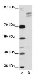 A: Marker, B: HepG2 Cell Lysate