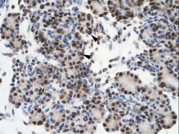 GTF2I / TFII-I antibody LS-C29903 was used in IHC to stain formalin-fixed, paraffin-embedded human pancreas.