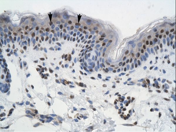 GTF2I / TFII-I antibody LS-C29903 was used in IHC to stain formalin-fixed, paraffin-embedded human skin.