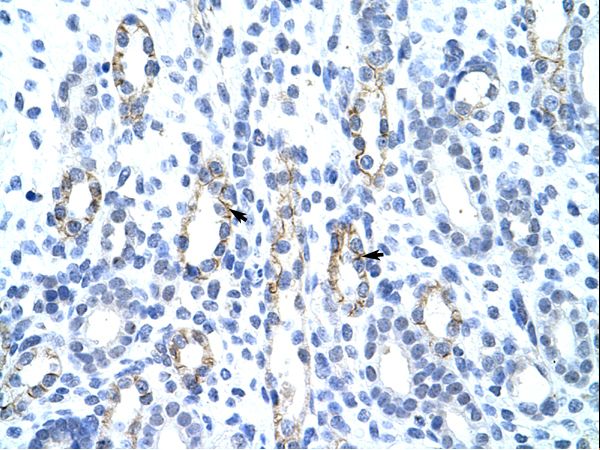 GTF2IRD1 antibody LS-C31823 was used in IHC to stain formalin-fixed, paraffin-embedded human kidney.