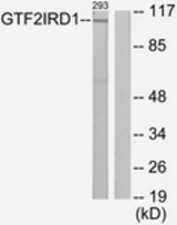 Western blot of extracts from 293 cells, using GTF2IRD1 Antibody. The lane on the right is treated with the synthesized peptide.