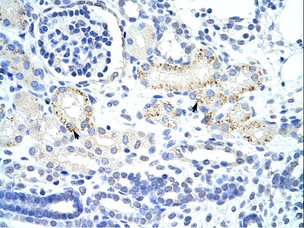 GTF2IRD1 antibody LS-C31822 was used in IHC to stain formalin-fixed, paraffin-embedded human kidney.