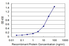Detection limit for recombinant GST tagged GTF3A is approximately 0.3 ng/ml as a capture antibody.