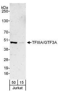 Detection of Human TFIIIA/GTF3A by Western Blot. Samples: Whole cell lysate (15 and 50 ug) from Jurkat cells. Antibodies: Affinity purified rabbit anti-TFIIIA/GTF3A antibody used for WB at 0.4 ug/ml. Detection: Chemiluminescence with an exposure time of 3 minutes.
