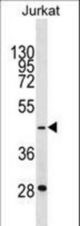 GTF3A Antibody western blot of Jurkat cell line lysates (35 ug/lane). The GTF3A antibody detected the GTF3A protein (arrow).
