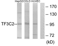 Western blot of extracts from HepG2/COLO205/HUVEC cells, using TF3C2 Antibody. The lane on the right is treated with the synthesized peptide.