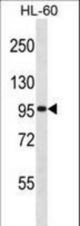 GTF3C2 Antibody western blot of HL-60 cell line lysates (35 ug/lane). The GTF3C2 antibody detected the GTF3C2 protein (arrow).