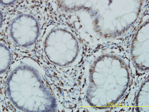 Immunoperoxidase of monoclonal antibody to GTF3C2 on formalin-fixed paraffin-embedded human colon tissue. [antibody concentration 1 ug/ml].