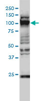 GTF3C2 monoclonal antibody (M01), clone 1C6-2B8 Western blot of GTF3C2 expression in HeLa NE.