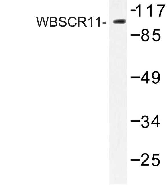Western blot of WBSCR11 (K94) pAb in extracts from 293 cells.