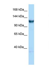 GTF3C3 antibody LS-C146085 Western blot of Rat Liver lysate. Antibody concentration 1 ug/ml.